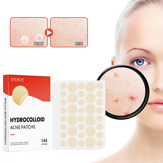144pcs/set Face Skin Care Acne Pimple Patch 2 Sizes Invisible Professional Healing Absorbing Spot Sticker Covering for Men  Women